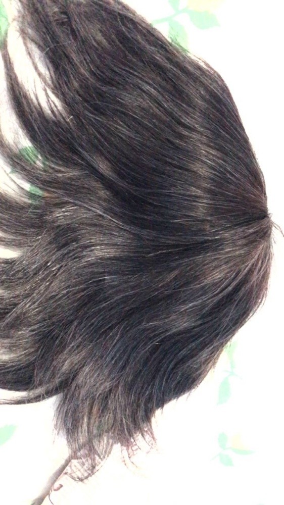 prothèse capillaire homme - 1