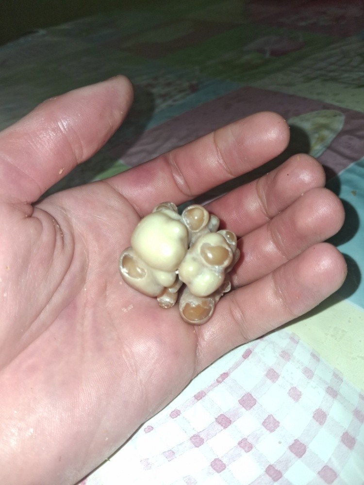 حجر نادر - 1