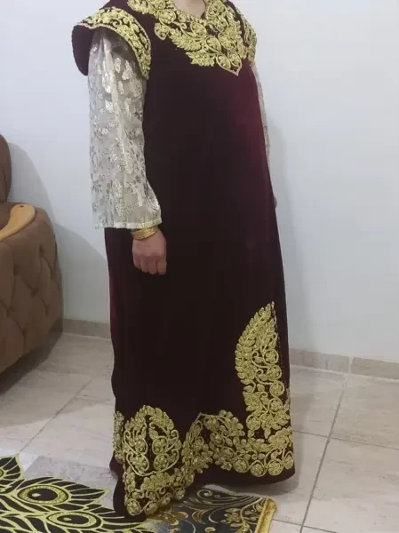 Robe Fetla - 1