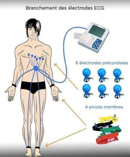 ممرضة متنقلة 